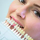 Veneers für ein perfektes Lächeln: Ablauf, Kosten und Pflege